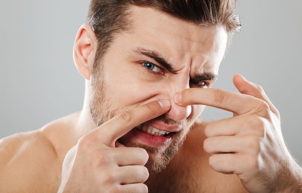 Bukan Karena Kotor! Inilah Alasan Komedo Hitam Selalu Kembali