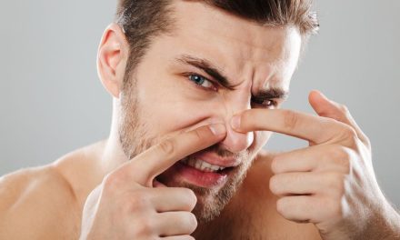 Bukan Karena Kotor! Inilah Alasan Komedo Hitam Selalu Kembali