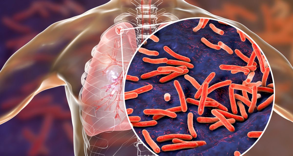 Jangan Tertipu! Klaim Herbal Bisa Sembuhkan TBC Ternyata Hoaks Besar!